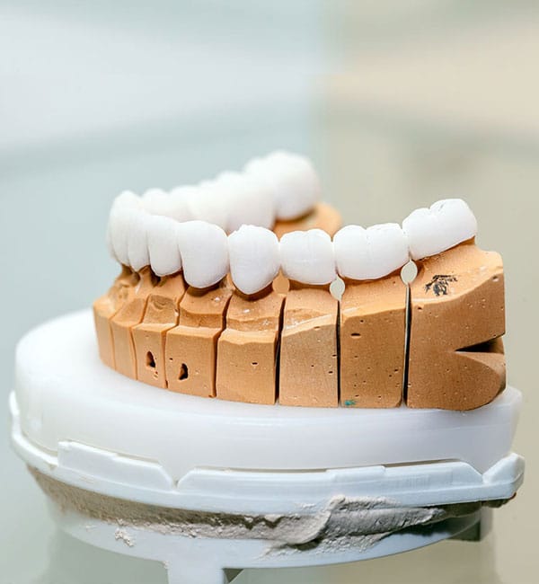 Dental model displaying teeth arrangement on white platform with tooth-colored blocks, dental education tool.