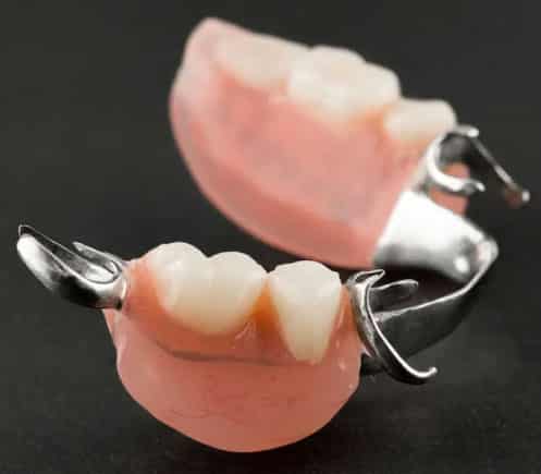 Partial dentures with metal clasps displayed on dark background, dental prosthetics showcase.